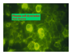 Plasma cell dyscrasias