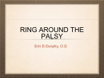 RING AROUND THE PALSY