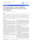 LCP external fixation - External application of an internal fixator: two