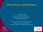 Ehlers-Danlos And Pregnancy
