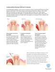 Scaling and Root Planning (SRP Gum Treatment) Periodontal (gum