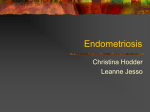 Endometriosis