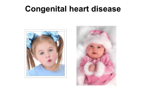 Congenital heart disease