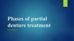 Phases of partial denture treatment