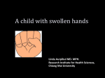 A child with swollen hands