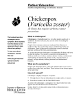 Pt Education-Chickenpox (Varicella zoster) - UWMC Health On-Line