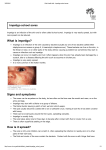 What is impetigo? Signs and symptoms How is it spread?