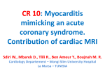 CR 10: Myocarditis mimicking an acute coronary syndrome