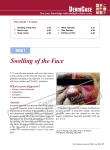 Swelling of the Face - STA HealthCare Communications