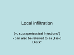 Local infiltration