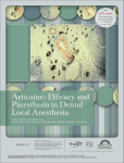 Articaine: Efficacy and Paresthesia in Dental Local Anesthesia