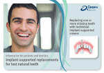 Implant-supported replacements for lost natural teeth
