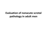 Evaluation of nonacute scrotal pathology in adult men VARICOCELE