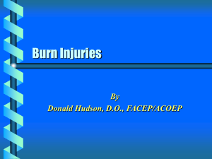 Burn Injuries - Donald Hudson Home