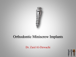 Orthodontic Miniscrew Implants