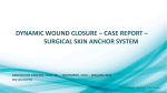 dynamic wound closure – case report – surgical skin anchor system