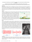 Using respiratory biofeedback games in pediatric MRI