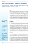 Bone scintigraphy depicts bilateral atypical femoral stress fractures