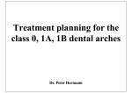 Treatment planning for the class 0, 1A, 1B dental arches Treatment