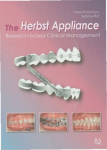 The Herbst Appliance Research based