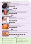 woundchart